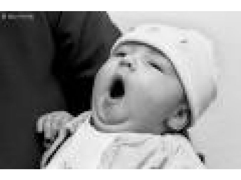 Yawning Infant (Caucasian Male)